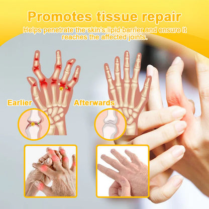 Official Store:TLOPA® Botulinum Toxin & Bee Venom Pain-Relief Bone Healing Cream🌞
