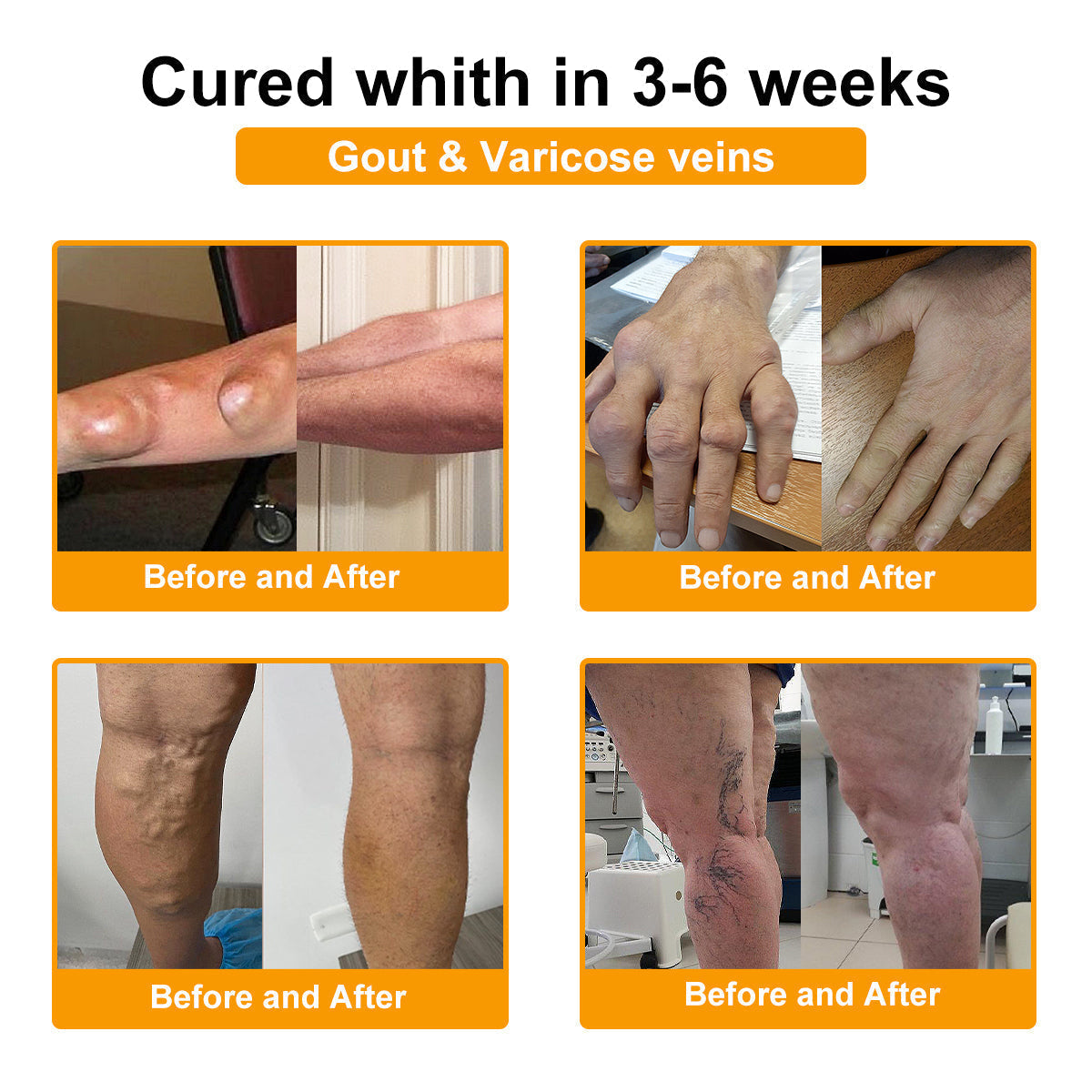 Official Store:TLOPA® Botulinum Toxin & Bee Venom Pain-Relief Bone Healing Cream🌞
