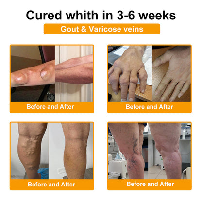 Official Store:TLOPA® Botulinum Toxin & Bee Venom Pain-Relief Bone Healing Cream🌞