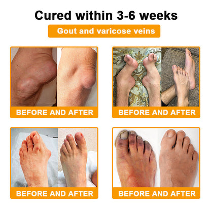 Official Store:TLOPA® Botulinum Toxin & Bee Venom Pain-Relief Bone Healing Cream🌞
