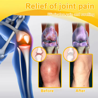 Official Store:TLOPA® Botulinum Toxin & Bee Venom Pain-Relief Bone Healing Cream🌞