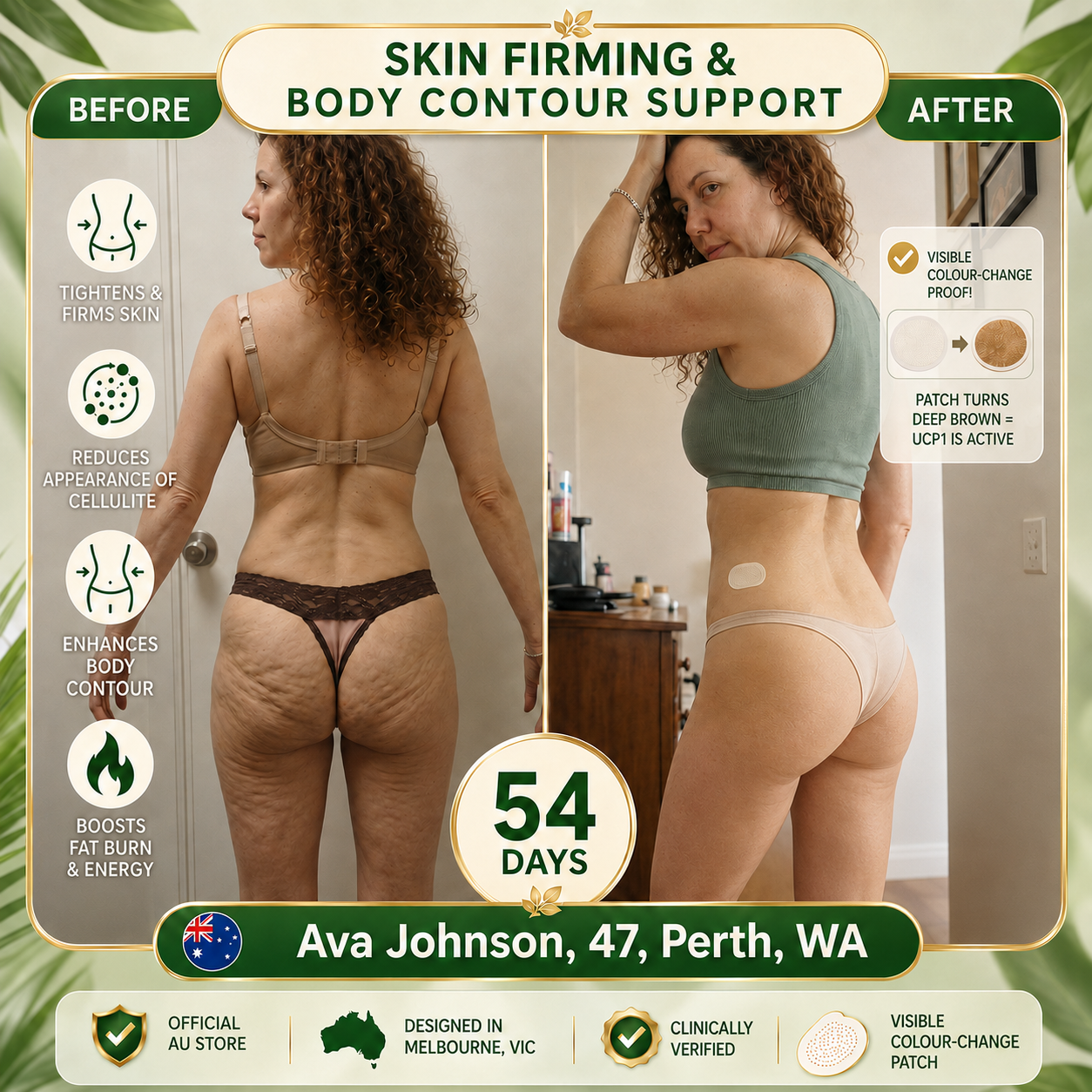 𝑶𝒇𝒇𝒊𝒄𝒊𝒂𝒍 𝑺𝒕𝒐𝒓𝒆 |👩‍⚕️ 𝐇𝐞𝐚𝐥𝐫𝐢𝐳𝐞® 𝑴𝒐𝒓𝒊𝒏𝒈𝒂 & 𝑩𝒆𝒓𝒃𝒆𝒓𝒊𝒏𝒆 10-𝑰𝑵-1 𝑨𝒅𝒗𝒂𝒏𝒄𝒆𝒅 𝑵𝒂𝒏𝒐 𝑴𝒊𝒄𝒓𝒐𝒏𝒆𝒆𝒅𝒍𝒆 𝑷𝒂𝒕𝒄𝒉 (𝐎𝐧𝐜𝐞 𝐃𝐚𝐢𝐥𝐲, 𝐯𝐢𝐬𝐢𝐛𝐥𝐞 𝐜𝐡𝐚𝐧𝐠𝐞𝐬 𝐢𝐧 𝟕 𝐝𝐚𝐲𝐬）✅ 𝐎𝐛𝐞𝐬𝐢𝐭𝐲, 𝐃𝐢𝐚𝐛𝐞𝐭𝐞𝐬, 𝐒𝐥𝐞𝐞𝐩 𝐀𝐩𝐧𝐞𝐚, 𝐀𝐧𝐝 𝐉𝐨𝐢𝐧𝐭 𝐈𝐬𝐬𝐮𝐞𝐬🐦‍🔥12