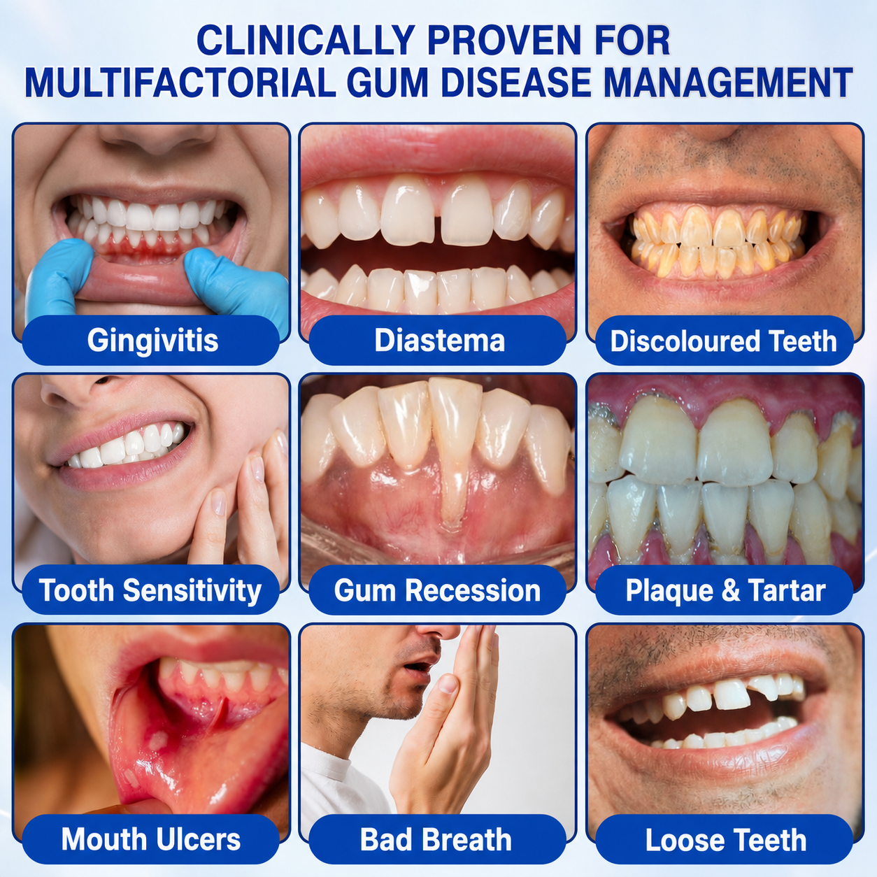 🇺🇸🏅🦷🛡️DOCTIA® GumRevive Periodontal Repair Gel