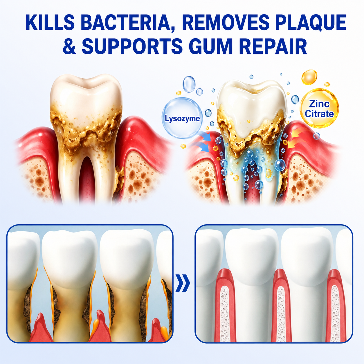 🇺🇸🏅🦷🛡️DOCTIA® GumRevive Periodontal Repair Gel
