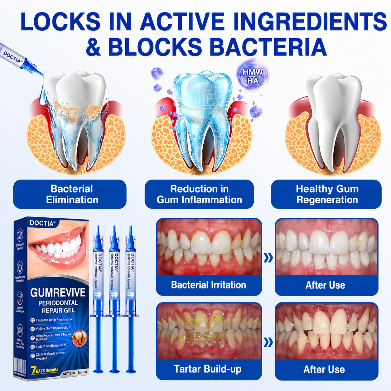 🇺🇸🏅🦷🛡️DOCTIA® GumRevive Periodontal Repair Gel