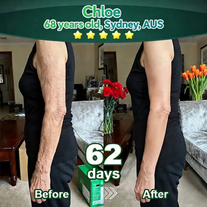 𝐎𝐟𝐟𝐢𝐜𝐢𝐚𝐥𝐥𝐲 𝐀𝐮𝐭𝐡𝐨𝐫𝐢𝐬𝐞𝐝 𝑬𝒙𝒄𝒍𝒖𝒔𝒊𝒗𝒆 𝑬𝒅𝒊𝒕𝒊𝒐𝒏✅𝑇𝑟𝑖𝑙𝑢𝑚𝑖𝑎® 𝖢𝗁𝗅𝗈𝗋𝗈𝗉𝗁𝗒𝗅𝗅 & 𝑆𝑡𝑒𝑚 𝐶𝑒𝑙𝑙 𝖻𝗈𝖽𝗒 𝗋𝖾𝗇𝖾𝗐𝖺𝗅 𝗌𝖾𝗋𝗎𝗆（𝐿𝑖𝑓𝑡 & 𝐹𝑖𝑟𝑚 𝑆𝑎𝑔𝑔𝑖𝑛𝑔 𝑆𝑘𝑖𝑛 & 𝑅𝑒𝑑𝑢𝑐𝑒 𝑊𝑟𝑖𝑛𝑘𝑙𝑒 𝐹𝑜𝑟𝑚𝑎𝑡𝑖𝑜𝑛👍