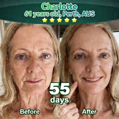 𝐎𝐟𝐟𝐢𝐜𝐢𝐚𝐥𝐥𝐲 𝐀𝐮𝐭𝐡𝐨𝐫𝐢𝐬𝐞𝐝 𝑬𝒙𝒄𝒍𝒖𝒔𝒊𝒗𝒆 𝑬𝒅𝒊𝒕𝒊𝒐𝒏✅𝑇𝑟𝑖𝑙𝑢𝑚𝑖𝑎® 𝖢𝗁𝗅𝗈𝗋𝗈𝗉𝗁𝗒𝗅𝗅 & 𝑆𝑡𝑒𝑚 𝐶𝑒𝑙𝑙 𝖻𝗈𝖽𝗒 𝗋𝖾𝗇𝖾𝗐𝖺𝗅 𝗌𝖾𝗋𝗎𝗆（𝐿𝑖𝑓𝑡 & 𝐹𝑖𝑟𝑚 𝑆𝑎𝑔𝑔𝑖𝑛𝑔 𝑆𝑘𝑖𝑛 & 𝑅𝑒𝑑𝑢𝑐𝑒 𝑊𝑟𝑖𝑛𝑘𝑙𝑒 𝐹𝑜𝑟𝑚𝑎𝑡𝑖𝑜𝑛👍