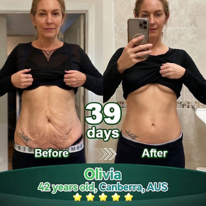 𝐎𝐟𝐟𝐢𝐜𝐢𝐚𝐥𝐥𝐲 𝐀𝐮𝐭𝐡𝐨𝐫𝐢𝐬𝐞𝐝 𝑬𝒙𝒄𝒍𝒖𝒔𝒊𝒗𝒆 𝑬𝒅𝒊𝒕𝒊𝒐𝒏✅𝑇𝑟𝑖𝑙𝑢𝑚𝑖𝑎® 𝖢𝗁𝗅𝗈𝗋𝗈𝗉𝗁𝗒𝗅𝗅 & 𝑆𝑡𝑒𝑚 𝐶𝑒𝑙𝑙 𝖻𝗈𝖽𝗒 𝗋𝖾𝗇𝖾𝗐𝖺𝗅 𝗌𝖾𝗋𝗎𝗆（𝐿𝑖𝑓𝑡 & 𝐹𝑖𝑟𝑚 𝑆𝑎𝑔𝑔𝑖𝑛𝑔 𝑆𝑘𝑖𝑛 & 𝑅𝑒𝑑𝑢𝑐𝑒 𝑊𝑟𝑖𝑛𝑘𝑙𝑒 𝐹𝑜𝑟𝑚𝑎𝑡𝑖𝑜𝑛👍